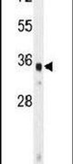 WDR5B Antibody in Western Blot (WB)