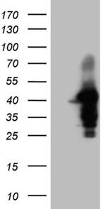 WDR92 Antibody in Western Blot (WB)