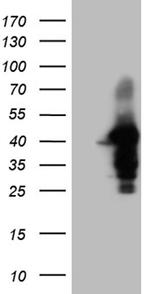 WDR92 Antibody in Western Blot (WB)