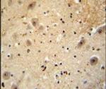 WDSOF1 Antibody in Immunohistochemistry (IHC)