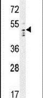 WDSOF1 Antibody in Western Blot (WB)