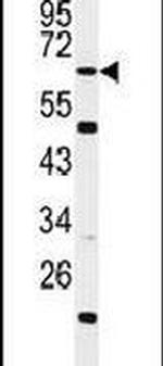 WDTC1 Antibody in Western Blot (WB)