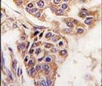 WDYHV1 Antibody in Immunohistochemistry (IHC)