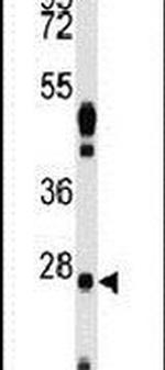 WDYHV1 Antibody in Western Blot (WB)