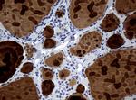 WFDC2 Antibody in Immunohistochemistry (Paraffin) (IHC (P))