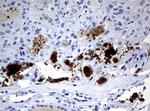 WFDC2 Antibody in Immunohistochemistry (Paraffin) (IHC (P))