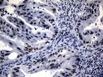 WHSC1L1 Antibody in Immunohistochemistry (Paraffin) (IHC (P))