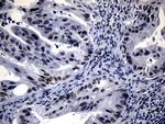WHSC1L1 Antibody in Immunohistochemistry (Paraffin) (IHC (P))