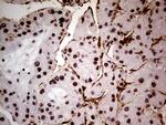WHSC1L1 Antibody in Immunohistochemistry (Paraffin) (IHC (P))
