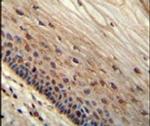 WIBG Antibody in Immunohistochemistry (IHC)