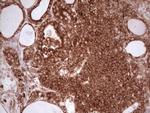 WIBG Antibody in Immunohistochemistry (Paraffin) (IHC (P))