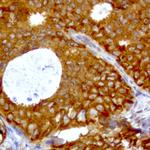 WIBG Antibody in Immunohistochemistry (Paraffin) (IHC (P))
