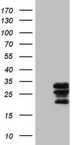 WIBG Antibody in Western Blot (WB)