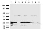 WIBG Antibody in Western Blot (WB)