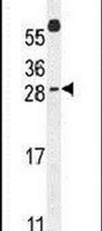 WIBG Antibody in Western Blot (WB)