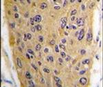 WIF1 Antibody in Immunohistochemistry (IHC)