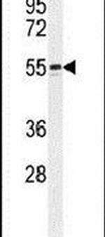WIPF2 Antibody in Western Blot (WB)