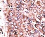 WISP3 Antibody in Immunohistochemistry (IHC)