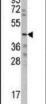 WISP3 Antibody in Western Blot (WB)
