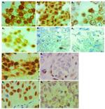 Glucocorticoid Receptor Antibody in Immunohistochemistry (Paraffin) (IHC (P))