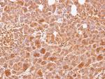 WNT10B Antibody in Immunohistochemistry (IHC)