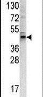 WNT4 Antibody in Western Blot (WB)