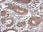 WNT6 Antibody in Immunohistochemistry (IHC)