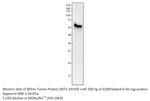 Wilms Tumor Protein Polyclonal Antibody