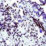 WT1 Antibody in Immunohistochemistry (IHC)