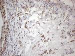 WTAP Antibody in Immunohistochemistry (Paraffin) (IHC (P))