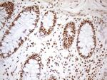 WTAP Antibody in Immunohistochemistry (Paraffin) (IHC (P))