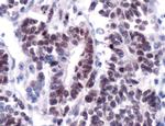 WT1 Antibody in Immunohistochemistry (IHC)
