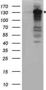 XPC Antibody in Western Blot (WB)