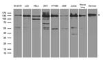 XPC Antibody in Western Blot (WB)