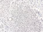 XPF Antibody in Immunohistochemistry (Paraffin) (IHC (P))