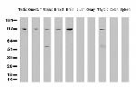 XPF Antibody in Western Blot (WB)