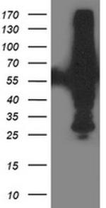 XPNPEP3 Antibody in Western Blot (WB)