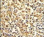 XPOT Antibody in Immunohistochemistry (IHC)