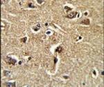 XPOT Antibody in Immunohistochemistry (IHC)