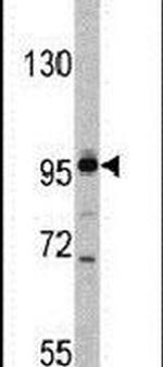 XPOT Antibody in Western Blot (WB)