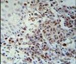 XRCC1 Antibody in Immunohistochemistry (IHC)