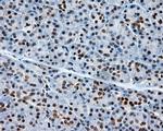 XRCC1 Antibody in Immunohistochemistry (Paraffin) (IHC (P))