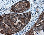 XRCC1 Antibody in Immunohistochemistry (Paraffin) (IHC (P))