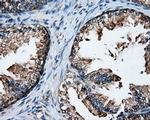 XRCC1 Antibody in Immunohistochemistry (Paraffin) (IHC (P))