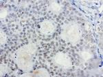 XRCC1 Antibody in Immunohistochemistry (Paraffin) (IHC (P))