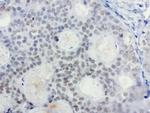 XRCC1 Antibody in Immunohistochemistry (Paraffin) (IHC (P))