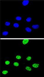 XRCC1 Antibody in Immunocytochemistry (ICC/IF)
