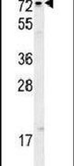 XRCC1 Antibody in Western Blot (WB)