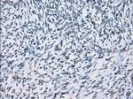 XRCC4 Antibody in Immunohistochemistry (Paraffin) (IHC (P))