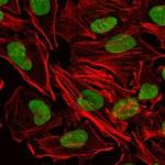 Ku80 Monoclonal Antibody (5C5)